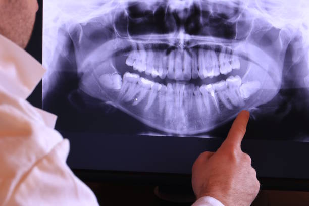 Best Emergency Tooth Extraction in Caribou, ME